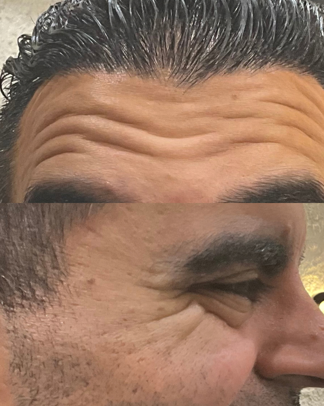 Before treatment