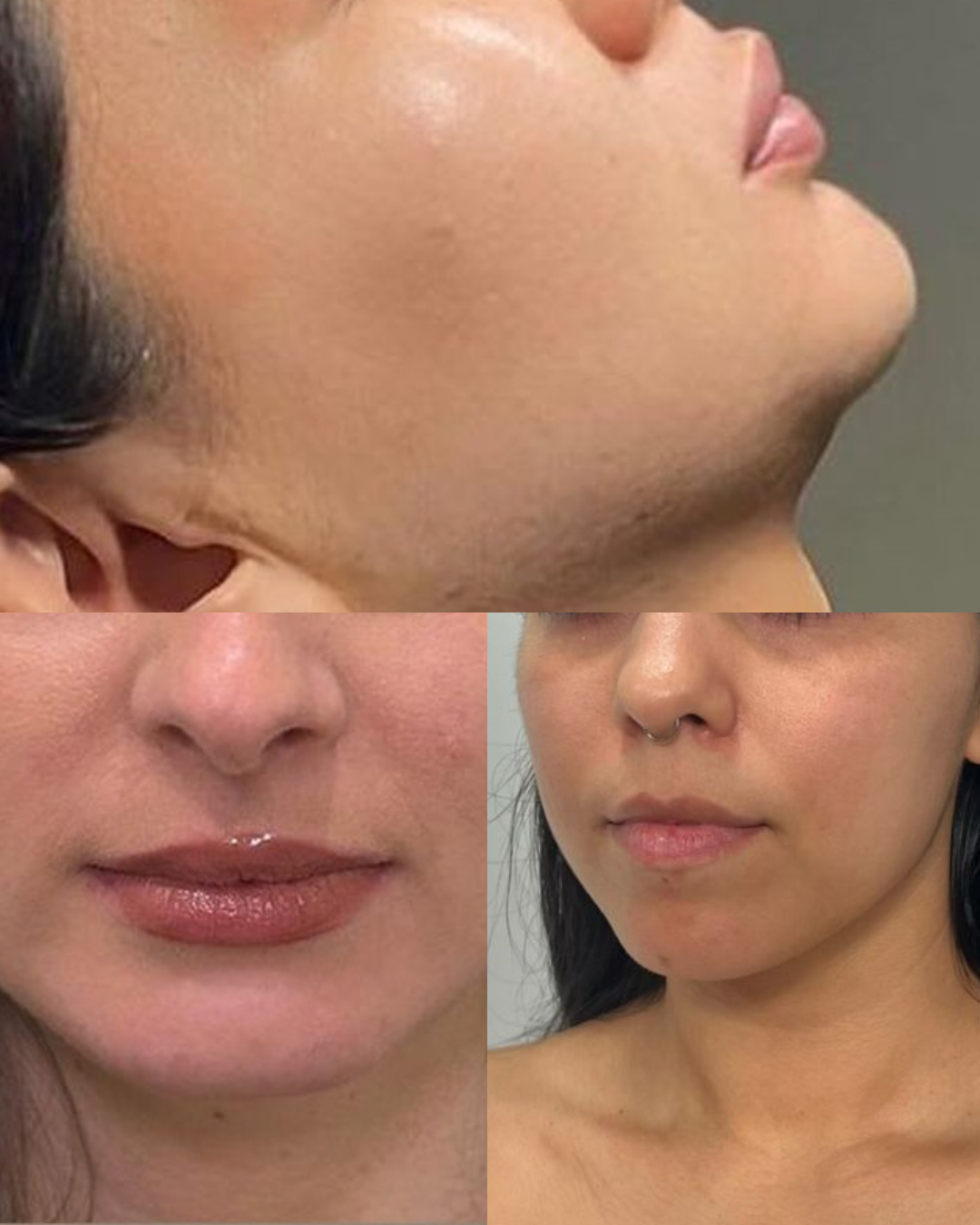 Before treatment