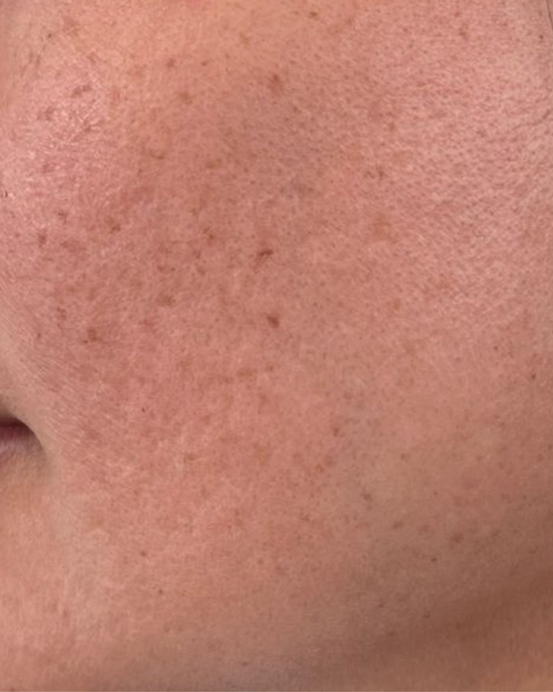 Before treatment